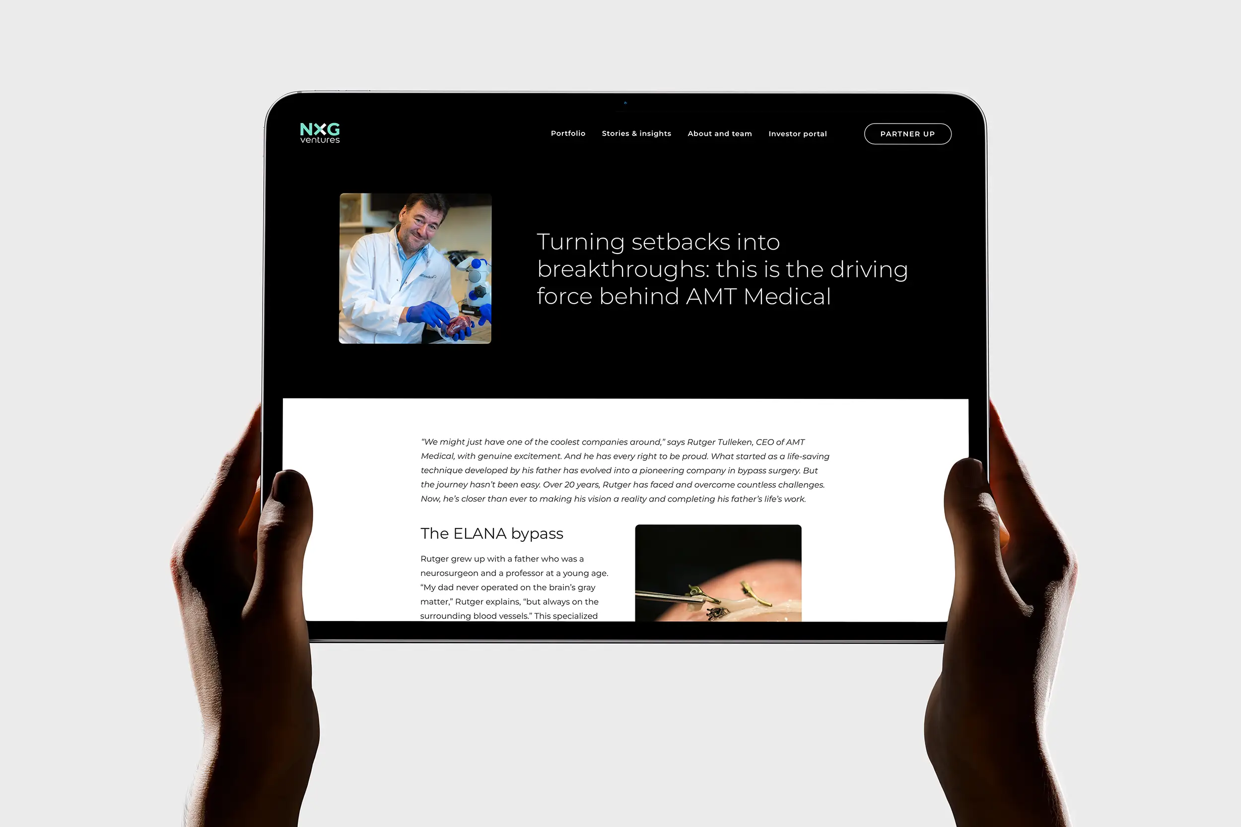 Stories insights NXG